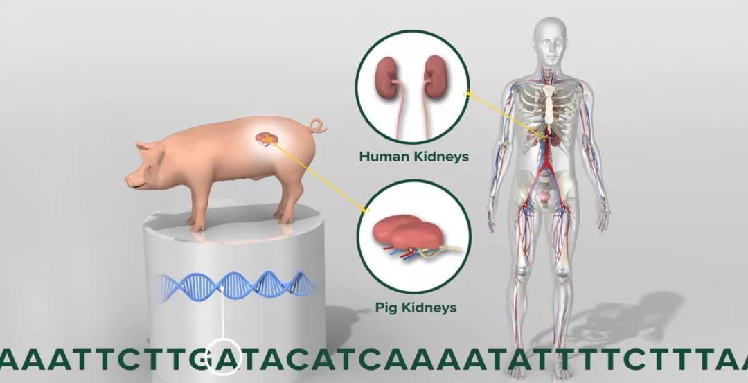 中国成功将猪肾和肝移植进人体