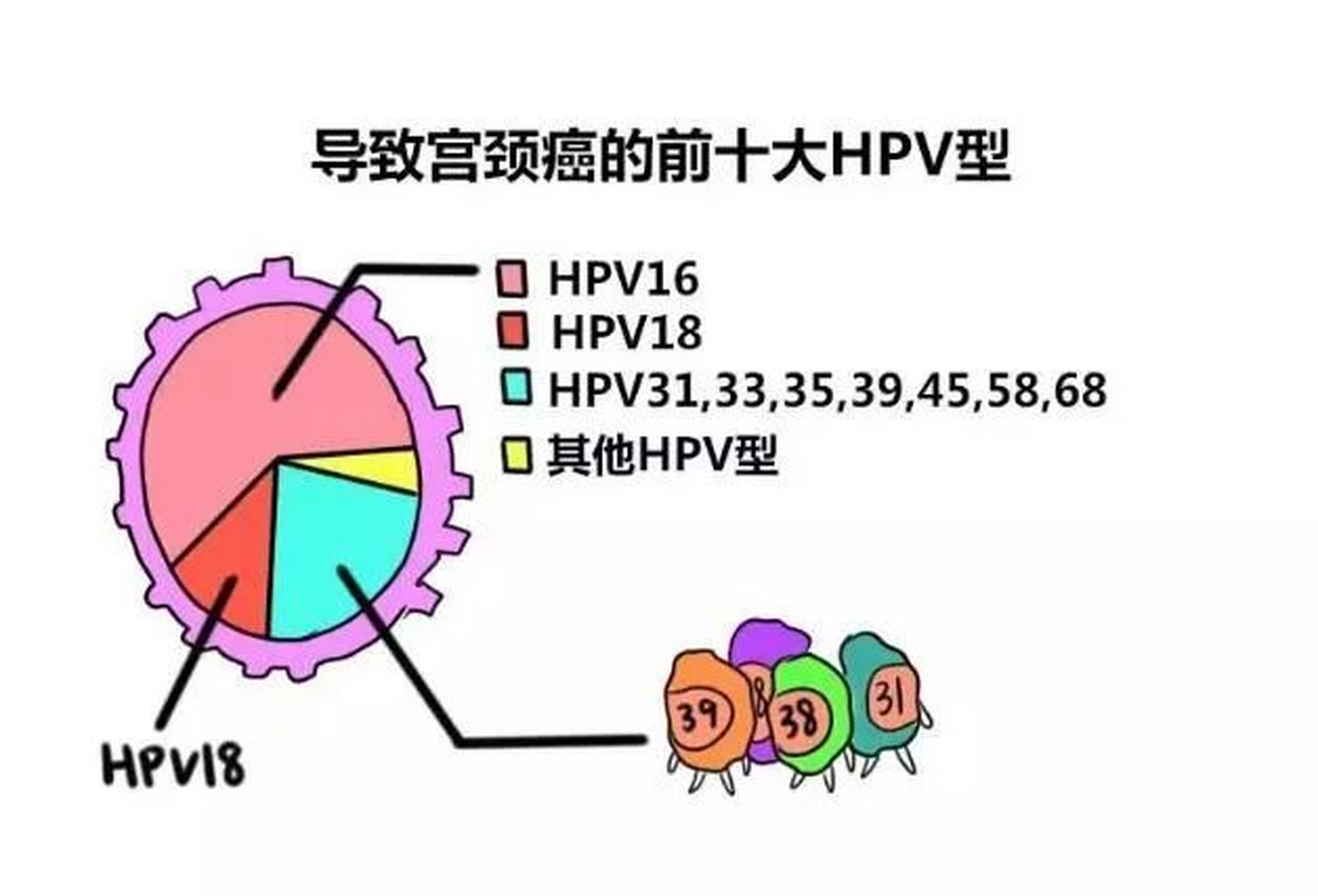 从HPV感染到宫颈癌只有5步