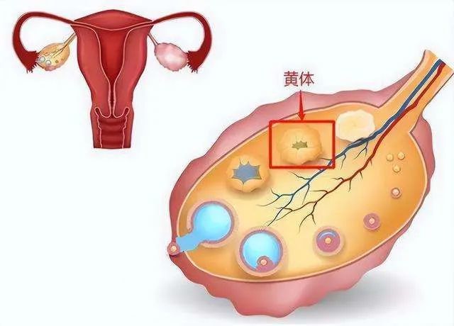 夫妻玩闹致妻子黄体破裂